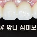 샤인치과기공소 이미지