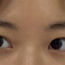 강남성모원안과의원 이미지