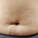 하얀메디컬의원 | 강남 붉은튼살 하얀튼살 레이저 치료 <A to Z> 공개