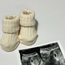 내돈내산 현대해상 태아종합보험 및 실비 발품팔아 가입한 후기(광고x) 및 정보