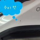 제일덴트칼라시스템 이미지