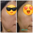 10월1주차 핑퐁연휴 (2), cu 키핑 아이스크림, 망포 떡다올 /초밥쟁이, 기미잡티색소 레이저 조지는 중