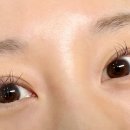 래쉬바이수 이미지