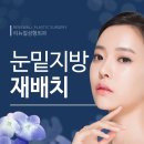 리뉴얼의원 이미지