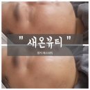 세온헬스케어 | [부산_명지]여름철 손상된 피부관리 명지에스테틱 추천 ! " 새온뷰티 " 에스테틱/금액/위치/주차/후기