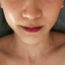 바른선 테라피 이미지