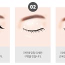 꼼꼼성형외과의원 네이버블로그