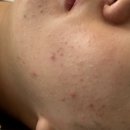 군자로 | 군자역 피부관리 바나나부띠끄 수분SOS리커버리 솔직후기