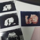 서울유의원 | 임신기록/ 임신 26주 5일차 입체 초음파 후기(평택 입초 저렴한 곳 추천)