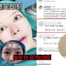 유튜브에서 성형외과 의사들이 중국 성형영상 리뷰하는거 봣는데 이미지