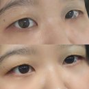 서울안평초등학교 | 장안동속눈썹펌 잘하는 뷰리싱 꼼꼼한 시술과 아로마테라피 후기