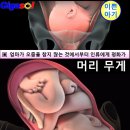 머리가 가장 무거운 10살 서연이~머리카락과 두피(01) 이미지