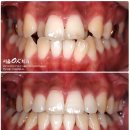 서울교정치과기공소 이미지