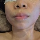에스테틱차온 | 부산 남천동 에스테틱 얼굴 윤곽 관리 받고온 후기