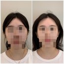 경상남도농업기술원 | 진주 얼굴 비대칭 고민 초전동 뷰티에이블 두골비 관리로 편안하게 해결하기