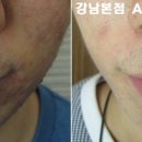 강남리유한의원 네이버블로그