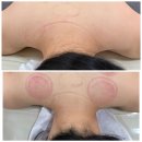 토르말린파워 | 전주 혁신도시 에스테틱 스페이스뷰티 전주 혁신점 체형관리 후기