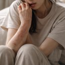 리바운드 | 아토피 리바운드 후기 – 약 끊고 겪은 현실 과정