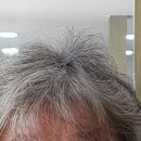 김효정헤어클리닉 이미지