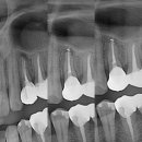 부평센트럴치과의원 이미지
