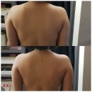 미옥에스테틱 | 울산 중구 우정동 등관리 : 직장인에게 강추하는 곳! 미옥에스테틱 후기! 동안얼굴 관리도 가능해요~