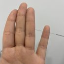 감초한의원 | 양산 일요일 한의원 생리통 대표원장의 셀프 치료 후기