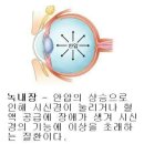 유니플러스비전 이미지