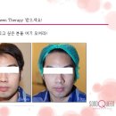 퀸테라피 이미지