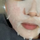 야누스 | 논현역피부과 리쥬베 하이쿡스 스킨부스터 내돈내산 야누스 피부진단 후기