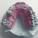 서울이바른치과교정과치과의원 | 인천치과 이바른치과교정과치과의원 치아 건강은 필수