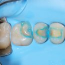 네츄럴치과기공소 이미지