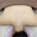 923 | 수원 승모근관리 923뷰티룸 드레스라인관리 후기