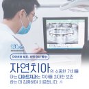 좋은치과 찾는법? 치과 실제후기 강남치과 디아트치과