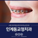 서대용치과의원 | 인계동교정치과 40대 여성분 돌출입 치아교정 실제 사례