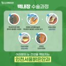 예가안경 | 백내장 수술 비용 실비 보험 청구 회복기간 알아보기