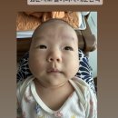 신생아 아토피 극복 후기(스테로이드x, 자연치유, 완정)