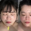 세븐일레븐대구만촌타운점 | [대구 오승연에스테틱]대구 얼굴윤곽관리 추천 오승연에스테틱 후기｜얼굴 비대칭 교정 &amp; 부종 관리...