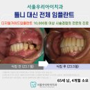 치아룸 치과기공소 이미지