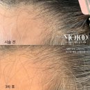 구로-구로-구로-2899 | 구로 두피 관리, 브로우기프트 구로점