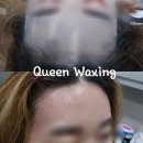 퀸헤어라인 이미지