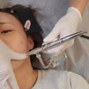 5785 | 오산 스킨플래닝 후기 |무모한 왁싱에서 처음 받아 본 얼굴잔털 제거 후기