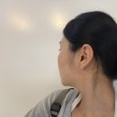 신사역 피부과/ 이중턱 고민, 엑셀웨이브 + 브이디파인 후기