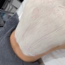 제이메디 | 울산 등드름 흉터 없애기 메디뷰제이 로즈드메드 등필링 후기