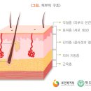 856. 피부노화 이미지