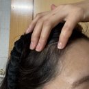 바른메디케어 | 바르는 흑채 노비어 사용법 및 솔직 후기