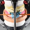 엠웍스 치과기공소 | #056 다수 치아 수복을 통한 교합 재정리 케이스