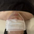 커피빈목동점 | [서울/양천구] 목동 에스테틱 얼굴 비대칭 크레이지 대칭 관리 끌리메 목동점 후기