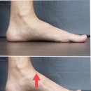 아치날 | 아치깔창 효과 내돈내산 솔직후기