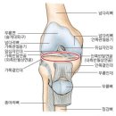 [질문] 제자리 점프후 무릎에 통증이 옵니다. 이미지