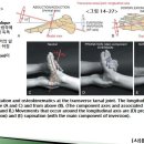 [11강-발목/발-9](88강) 가로발목관절의 움직임 축(세로축, 빗축), 편평발(pes planus), 오목발(pes cavus) 이미지